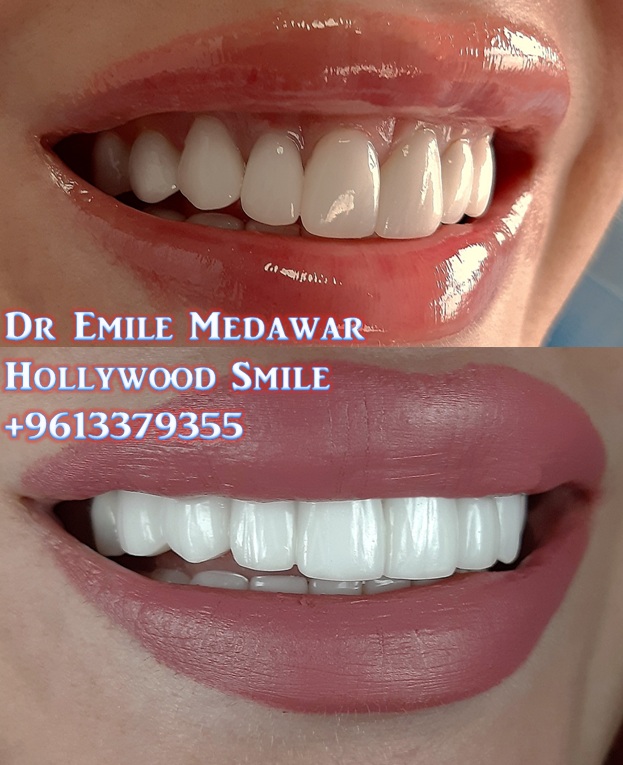 Top dentist in Lebanon Beirut